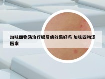 加味四物汤治疗银屑病效果好吗 加味四物汤医案