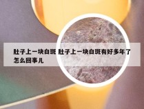 肚子上一块白斑 肚子上一块白斑有好多年了怎么回事儿