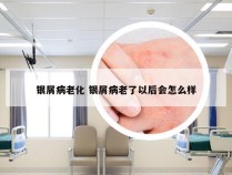 银屑病老化 银屑病老了以后会怎么样