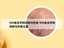 999皮炎平的功效与作用 999皮炎平的功效与作用儿童