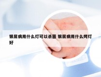 银屑病用什么灯可以杀菌 银屑病用什么烤灯好