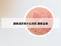 藏银成药有什么功效 藏银治病