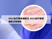 2023治疗银屑病新法 2023治疗银屑病新法有哪些