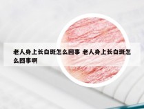 老人身上长白斑怎么回事 老人身上长白斑怎么回事啊