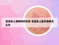 宝宝身上像癣样的东西 宝宝身上起的像癣怎么办