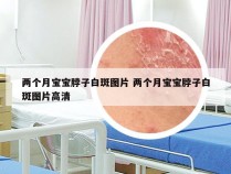 两个月宝宝脖子白斑图片 两个月宝宝脖子白斑图片高清