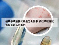 被蚊子咬后就长癣是怎么回事 被蚊子咬后就长癣是怎么回事啊