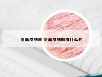 阴囊皮肤癣 阴囊皮肤癣用什么药