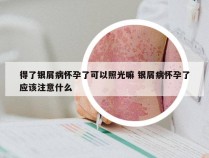 得了银屑病怀孕了可以照光嘛 银屑病怀孕了应该注意什么