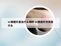 vc银翘片是治什么病的 vc银翘片作用是什么