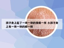 孩子身上起了一块一块的像癣一样 小孩子身上有一块一块的癣一样