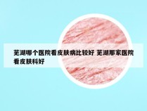 芜湖哪个医院看皮肤病比较好 芜湖那家医院看皮肤科好