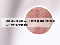 银屑病长期使用达力士好吗 银屑病长期使用达力士好吗会传染吗