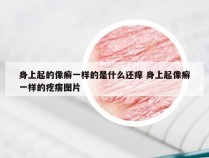 身上起的像癣一样的是什么还痒 身上起像癣一样的疙瘩图片