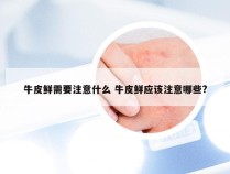 牛皮鲜需要注意什么 牛皮鲜应该注意哪些?