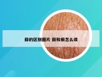 藓的区别图片 藓和癣怎么读