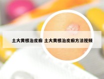 土大黄根治皮癣 土大黄根治皮癣方法视频