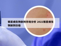 银屑病生物制剂市场分析 2021银屑病生物制剂价格