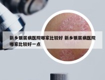 新乡银屑病医院哪家比较好 新乡银屑病医院哪家比较好一点