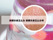 脚腰长癣怎么办 脚腰长癣怎么办啊