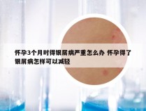 怀孕3个月时得银屑病严重怎么办 怀孕得了银屑病怎样可以减轻