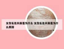 女生私处长藓是为什么 女生私处长藓是为什么原因