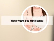 李时珍古方牛皮癣 李时珍治疗癣