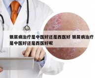 银屑病治疗是中医好还是西医好 银屑病治疗是中医好还是西医好呢