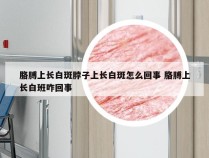 胳膊上长白斑脖子上长白斑怎么回事 胳膊上长白班咋回事