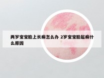 两岁宝宝脸上长癣怎么办 2岁宝宝脸起癣什么原因