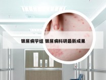 银屑病学组 银屑病科研最新成果