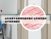 山东省看牛皮癣哪家医院最好 山东哪家医院治疗银屑病最好