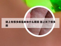 腿上有很多癣是身体什么原因 腿上长了很多藓