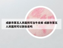 成都市第五人民医院可治牛皮癣 成都市第五人民医院可以割包皮吗