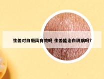 生姜对白癜风有效吗 生姜能治白斑病吗?