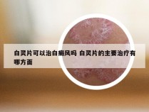 白灵片可以治白癜风吗 白灵片的主要治疗有哪方面