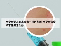 两个月婴儿身上有癣一样的东西 两个月宝宝长了体癣怎么办