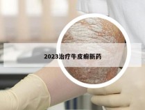 2023治疗牛皮癣新药