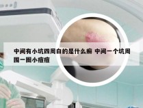 中间有小坑四周白的是什么癣 中间一个坑周围一圈小痘痘