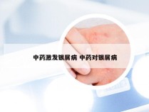 中药激发银屑病 中药对银屑病