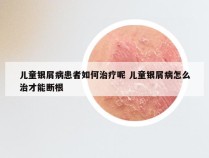 儿童银屑病患者如何治疗呢 儿童银屑病怎么治才能断根